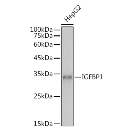 Western Blot - Anti-IGFBP1 Antibody (A14288) - Antibodies.com