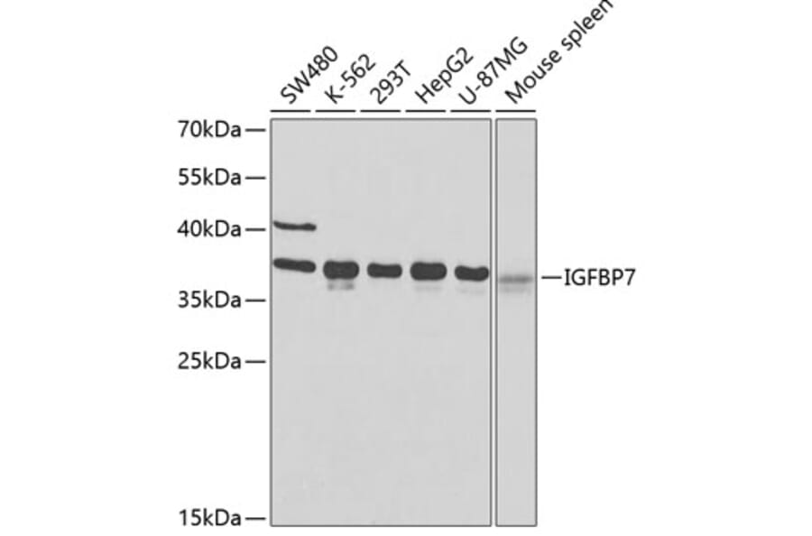 Western Blot - Anti-IGFBP7 Antibody (A2982) - Antibodies.com