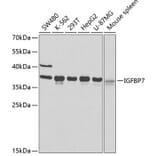 Western Blot - Anti-IGFBP7 Antibody (A2982) - Antibodies.com