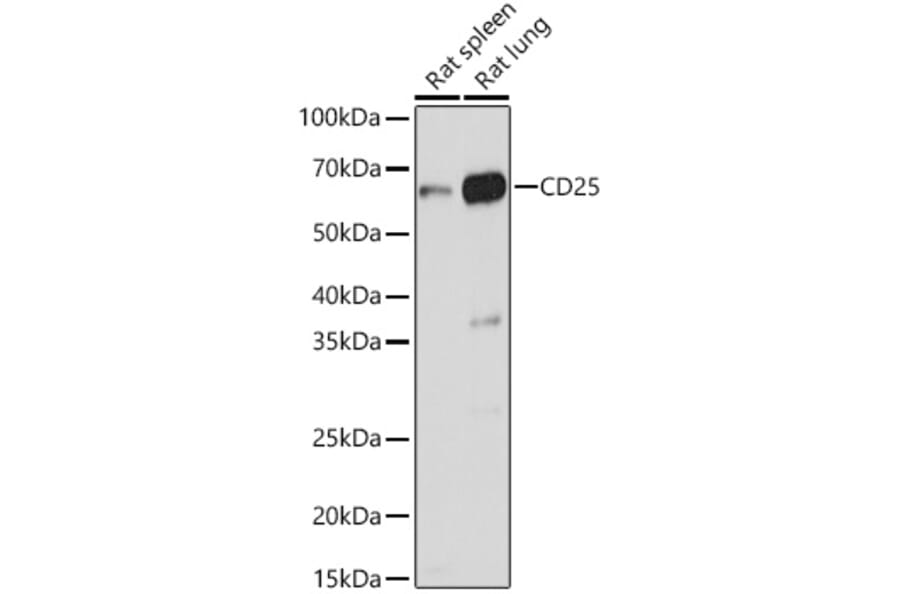 Western Blot - Anti-IL-2 Receptor alpha Antibody (A14290) - Antibodies.com