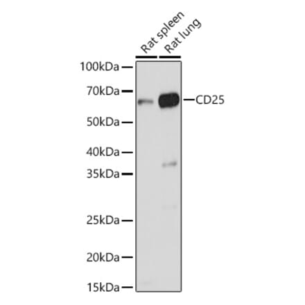 Western Blot - Anti-IL-2 Receptor alpha Antibody (A14290) - Antibodies.com