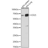 Western Blot - Anti-IL-2 Receptor alpha Antibody (A14290) - Antibodies.com