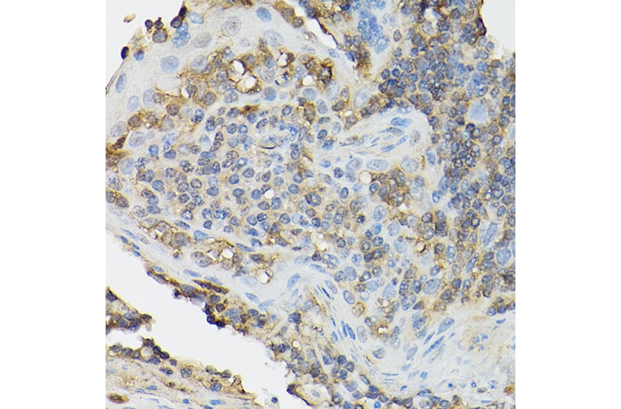 Immunohistochemistry - Anti-IL-2 Receptor alpha Antibody (A14290) - Antibodies.com
