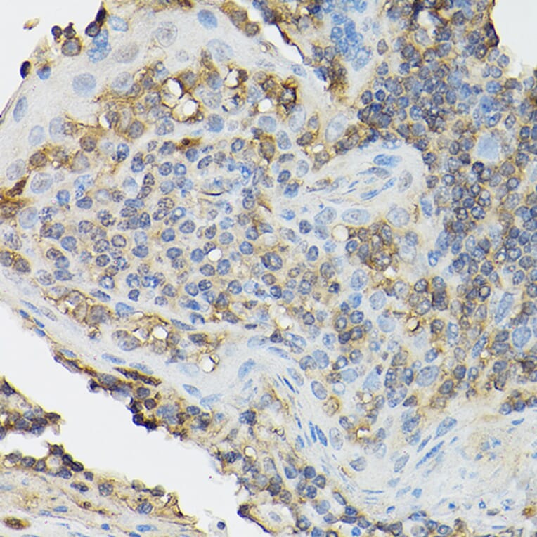 Immunohistochemistry - Anti-IL-2 Receptor alpha Antibody (A14290) - Antibodies.com