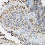 Immunohistochemistry - Anti-IL-2 Receptor alpha Antibody (A14290) - Antibodies.com