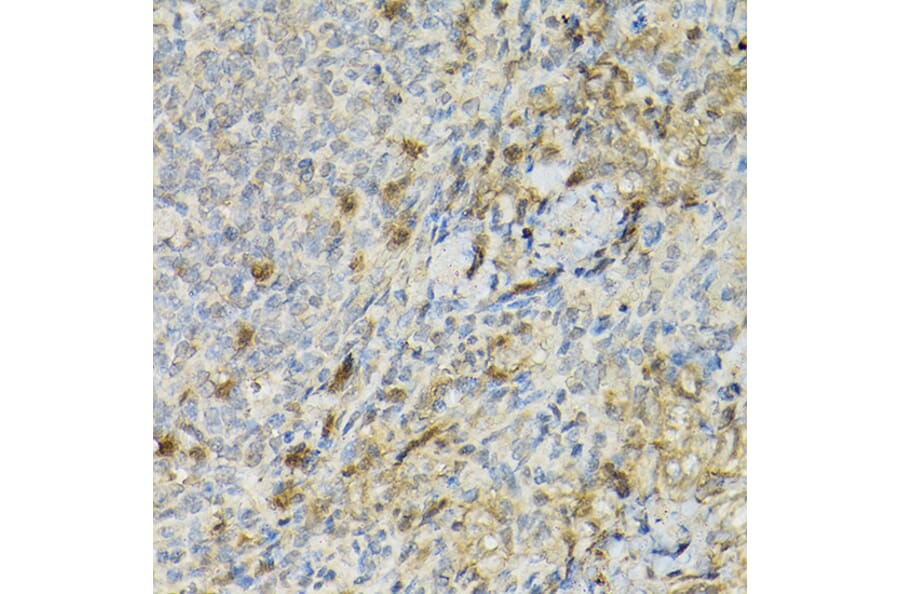 Immunohistochemistry - Anti-IL-2 Receptor alpha Antibody (A14290) - Antibodies.com