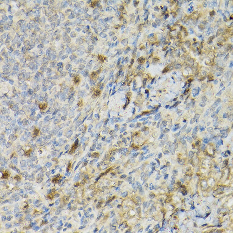 Immunohistochemistry - Anti-IL-2 Receptor alpha Antibody (A14290) - Antibodies.com