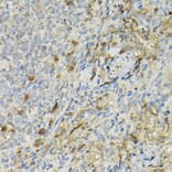 Immunohistochemistry - Anti-IL-2 Receptor alpha Antibody (A14290) - Antibodies.com