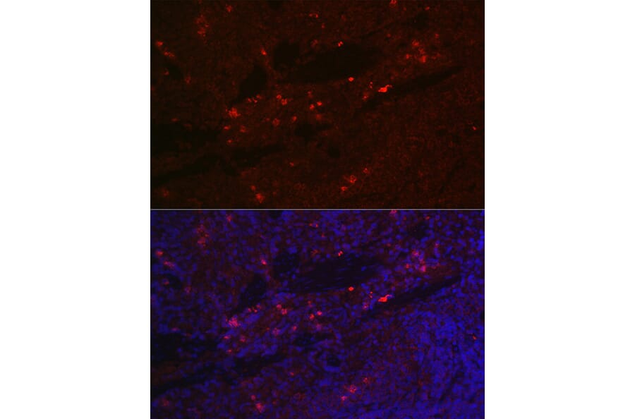 Immunofluorescence - Anti-IL-2 Receptor alpha Antibody (A14290) - Antibodies.com