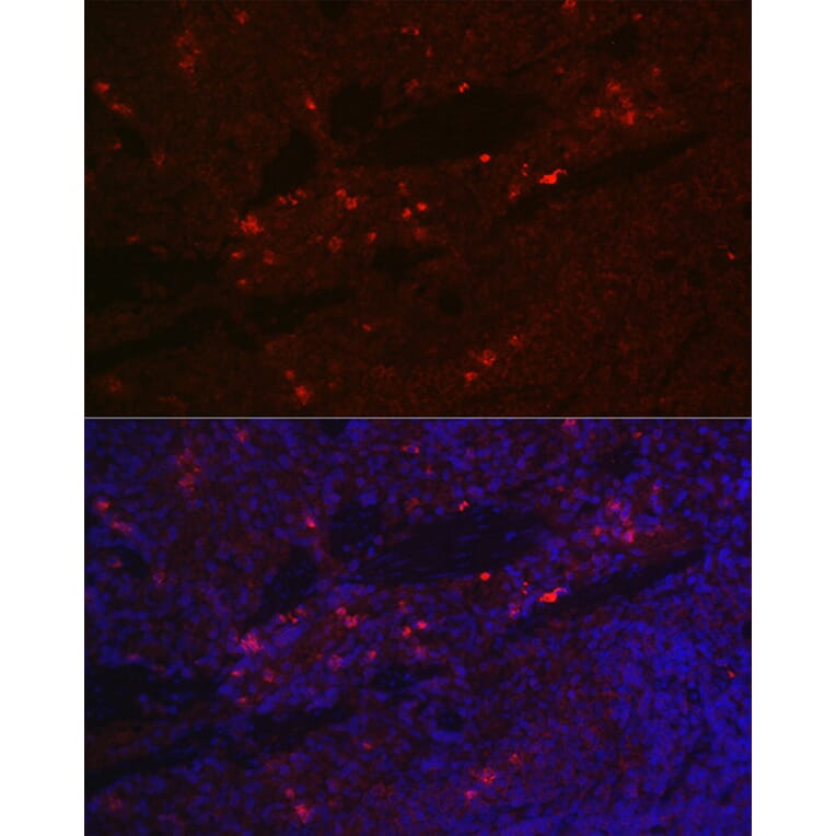 Immunofluorescence - Anti-IL-2 Receptor alpha Antibody (A14290) - Antibodies.com
