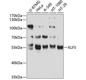 Western Blot - Anti-KLF5 Antibody (A14292) - Antibodies.com