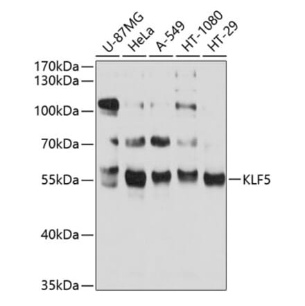 Western Blot - Anti-KLF5 Antibody (A14292) - Antibodies.com