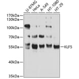 Western Blot - Anti-KLF5 Antibody (A14292) - Antibodies.com