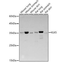 Western Blot - Anti-Kallikrein 5 Antibody (A14293) - Antibodies.com