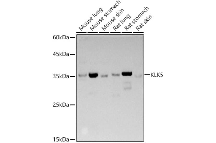 Western Blot - Anti-Kallikrein 5 Antibody (A14293) - Antibodies.com