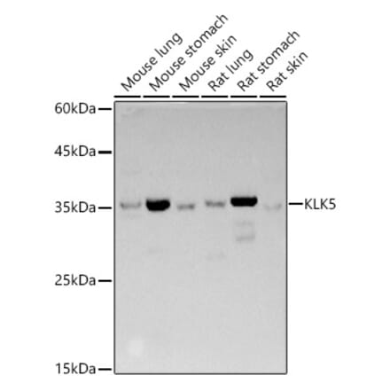 Western Blot - Anti-Kallikrein 5 Antibody (A14293) - Antibodies.com