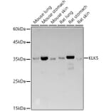 Western Blot - Anti-Kallikrein 5 Antibody (A14293) - Antibodies.com