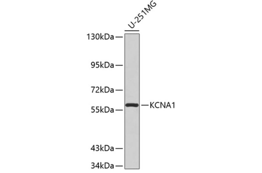 Western Blot - Anti-KCNA1 Antibody (A2992) - Antibodies.com