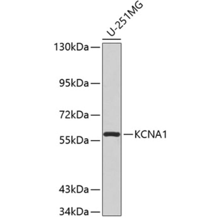 Western Blot - Anti-KCNA1 Antibody (A2992) - Antibodies.com