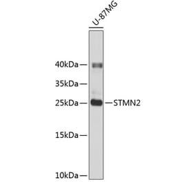 Western Blot - Anti-SCG10 Antibody (A14297) - Antibodies.com