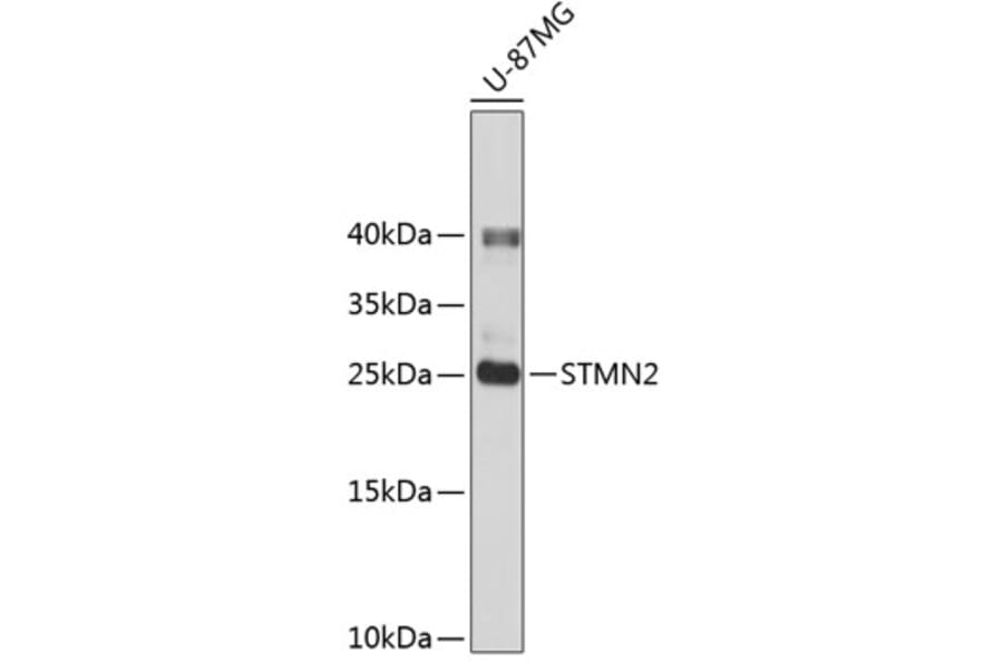 Western Blot - Anti-SCG10 Antibody (A14297) - Antibodies.com