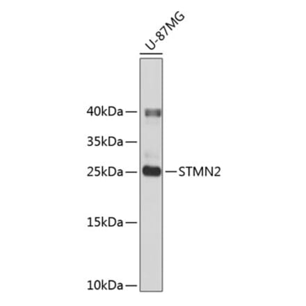 Western Blot - Anti-SCG10 Antibody (A14297) - Antibodies.com
