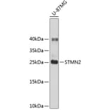 Western Blot - Anti-SCG10 Antibody (A14297) - Antibodies.com