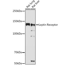Western Blot - Anti-Leptin Receptor Antibody (A14299) - Antibodies.com