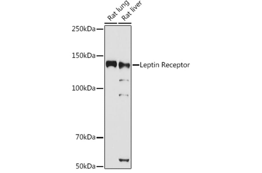 Western Blot - Anti-Leptin Receptor Antibody (A14299) - Antibodies.com