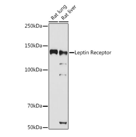 Western Blot - Anti-Leptin Receptor Antibody (A14299) - Antibodies.com