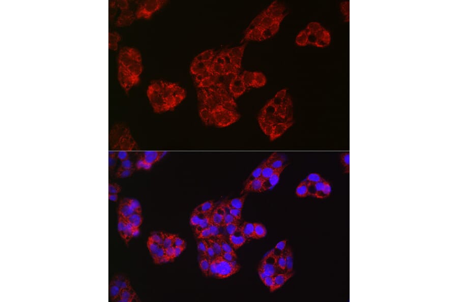 Immunofluorescence - Anti-Leptin Receptor Antibody (A14299) - Antibodies.com