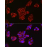 Immunofluorescence - Anti-Leptin Receptor Antibody (A14299) - Antibodies.com