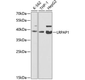 Western Blot - Anti-LRPAP1 Antibody (A14301) - Antibodies.com