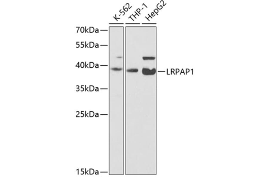 Western Blot - Anti-LRPAP1 Antibody (A14301) - Antibodies.com