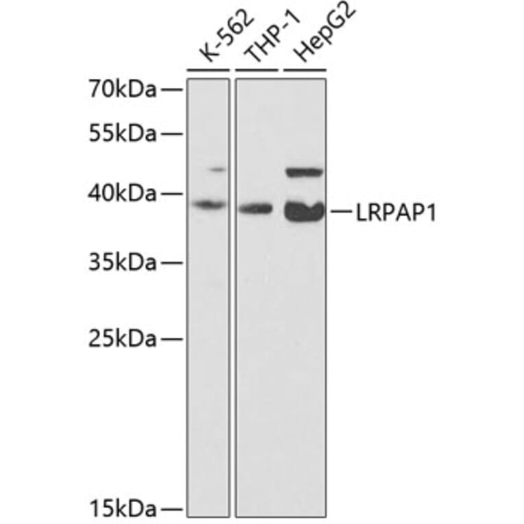 Western Blot - Anti-LRPAP1 Antibody (A14301) - Antibodies.com