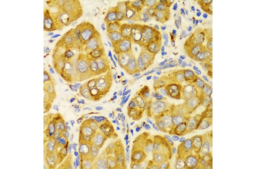 Immunohistochemistry - Anti-LRPAP1 Antibody (A14301) - Antibodies.com