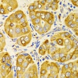 Immunohistochemistry - Anti-LRPAP1 Antibody (A14301) - Antibodies.com