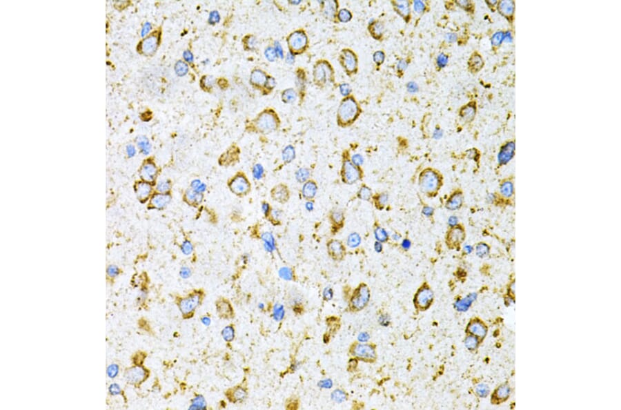 Immunohistochemistry - Anti-LRPAP1 Antibody (A14301) - Antibodies.com