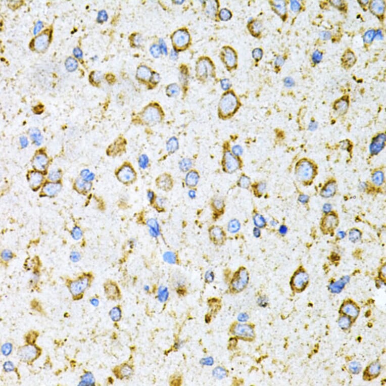 Immunohistochemistry - Anti-LRPAP1 Antibody (A14301) - Antibodies.com