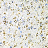 Immunohistochemistry - Anti-LRPAP1 Antibody (A14301) - Antibodies.com