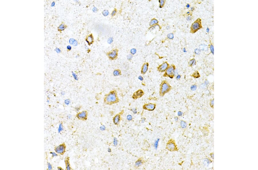 Immunohistochemistry - Anti-LRPAP1 Antibody (A14301) - Antibodies.com