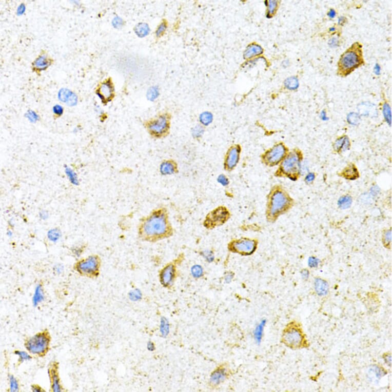 Immunohistochemistry - Anti-LRPAP1 Antibody (A14301) - Antibodies.com