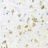 Immunohistochemistry - Anti-LRPAP1 Antibody (A14301) - Antibodies.com