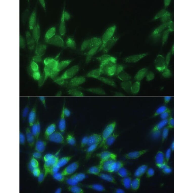 Immunofluorescence - Anti-LRPAP1 Antibody (A14301) - Antibodies.com