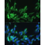 Immunofluorescence - Anti-LRPAP1 Antibody (A14301) - Antibodies.com