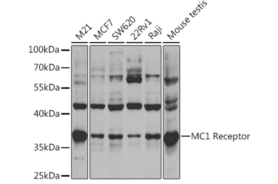 Western Blot - Anti-MC1-R Antibody (A14303) - Antibodies.com
