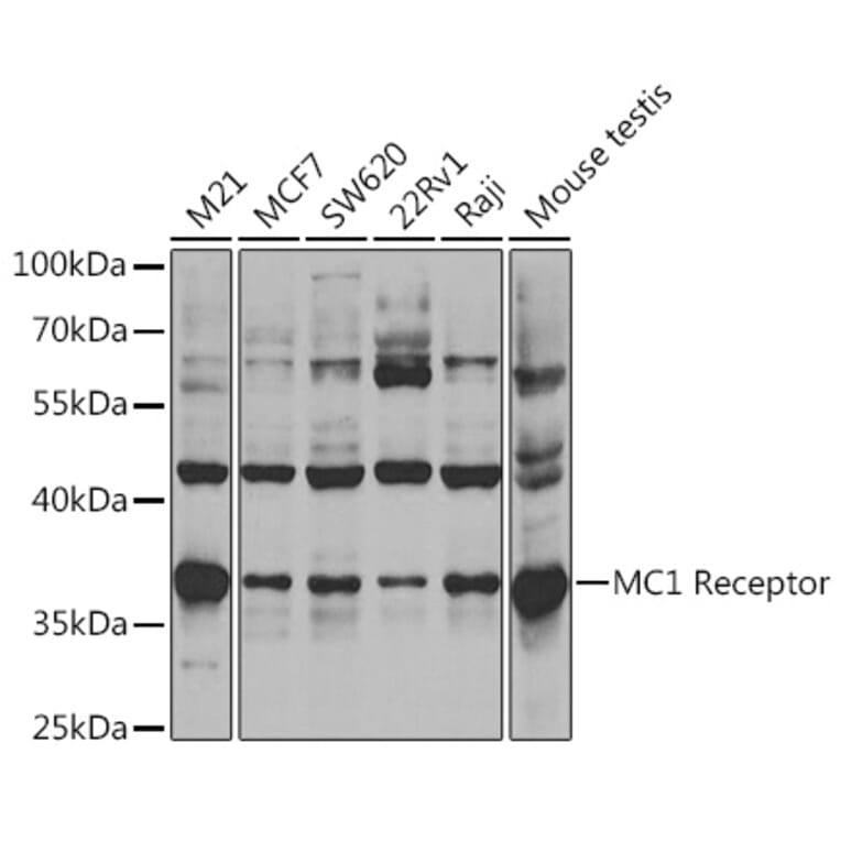 Western Blot - Anti-MC1-R Antibody (A14303) - Antibodies.com