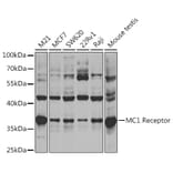 Western Blot - Anti-MC1-R Antibody (A14303) - Antibodies.com