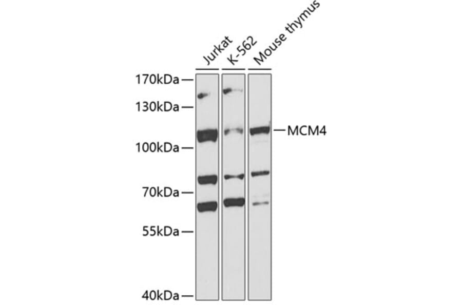 Western Blot - Anti-MCM4 Antibody (A14305) - Antibodies.com