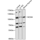 Western Blot - Anti-MCM4 Antibody (A14305) - Antibodies.com